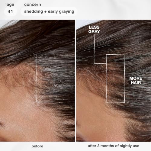 K18 FutureIQ Biomimetic Longevity Hair + Scalp Serum, 3.04 oz