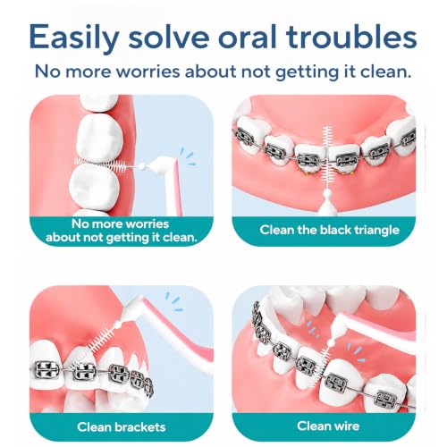 DR.CLEAN 0.9mm Angled Interdental Brushes for Braces