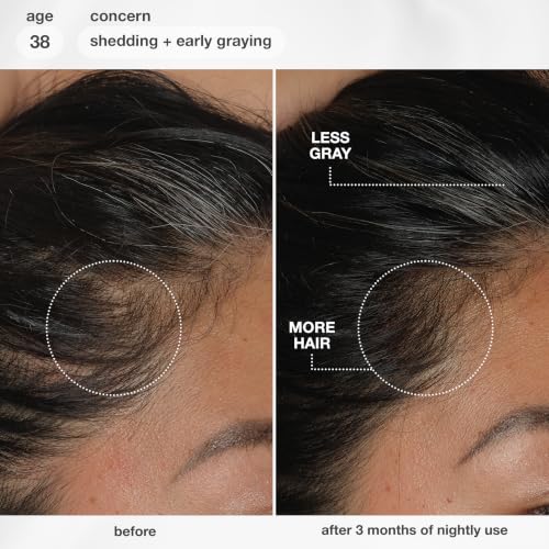 K18 FutureIQ Biomimetic Longevity Hair + Scalp Serum, 3.04 oz