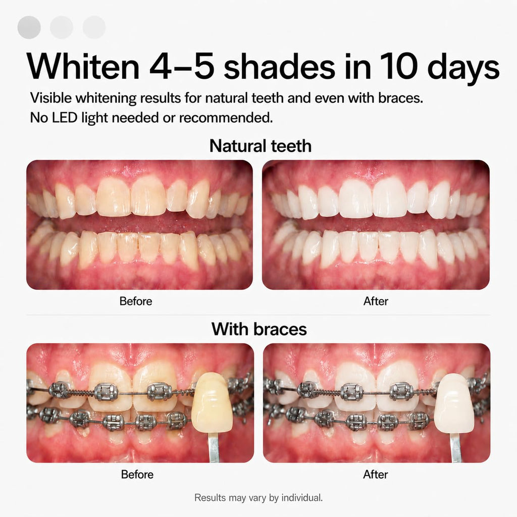 Opalescence GO 15% Teeth Whitening Trays & Toothpaste