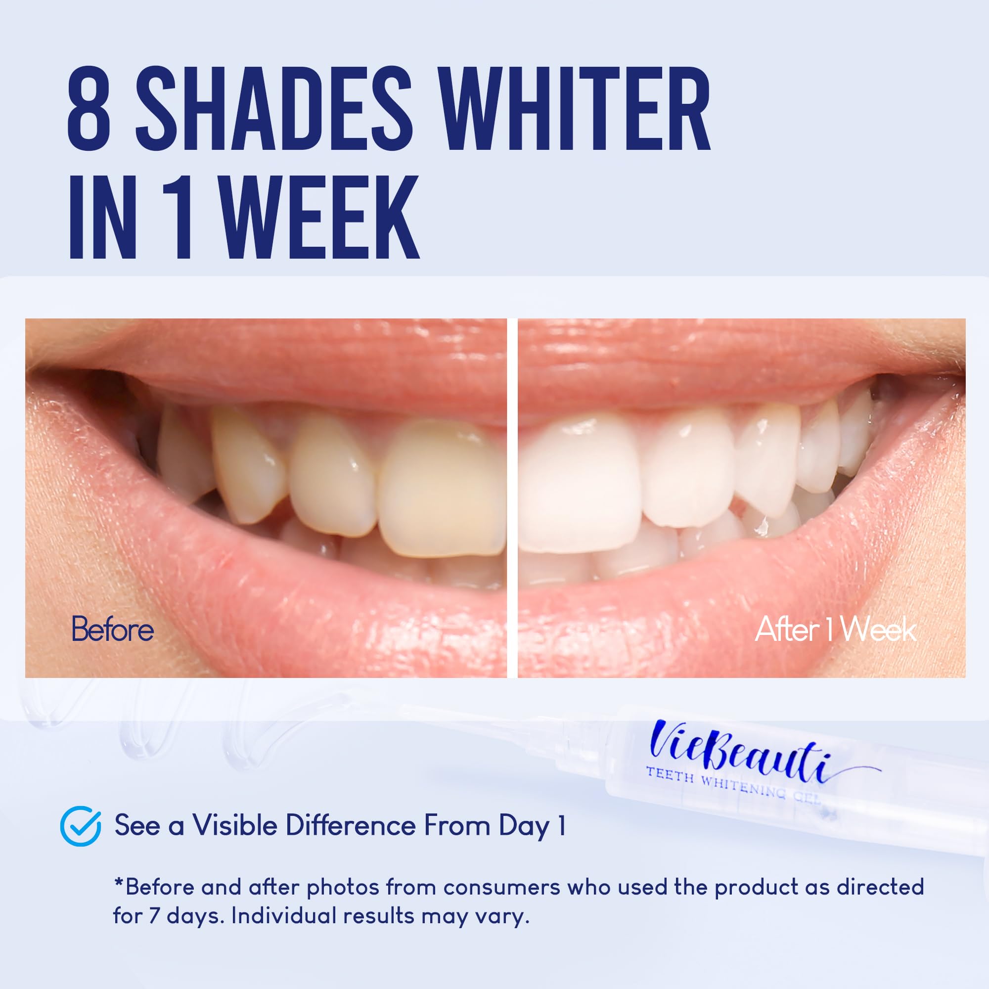 VieBeauti Teeth Whitening Pen & LED Kit for Sensitive Teeth