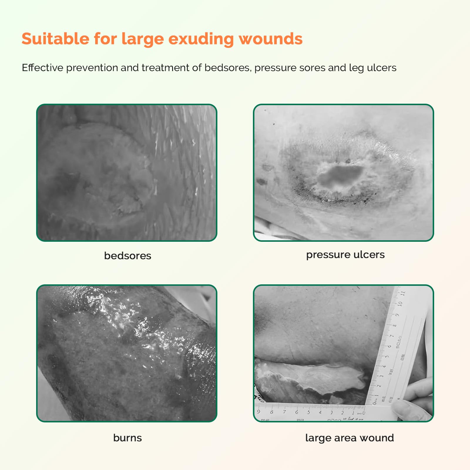 Sacrum Silicone Foam Wound Dressing for Pressure Care