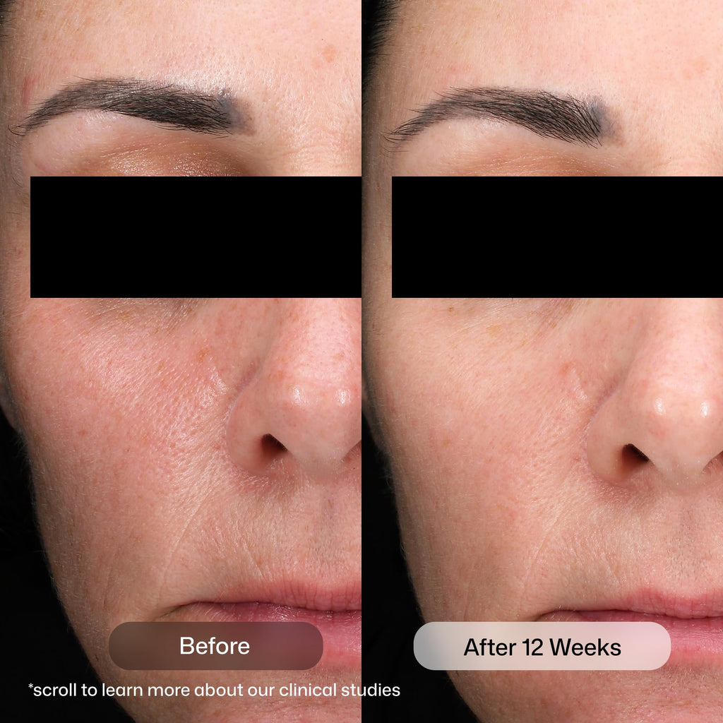 Revision Skincare D·E·J Daily Boosting Serum™, Anti Aging Serum, Reduces Wrinkles, Supports Skin Firmness and Skin Elasticity