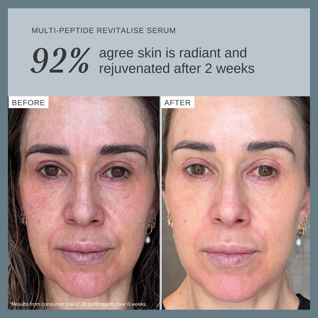 Alpha-H Melting Moment Cleansing Balm (90g) and Multi-Peptide Revitalise Serum 30ml Bundle